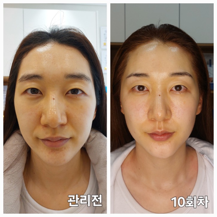 임상2.jpg